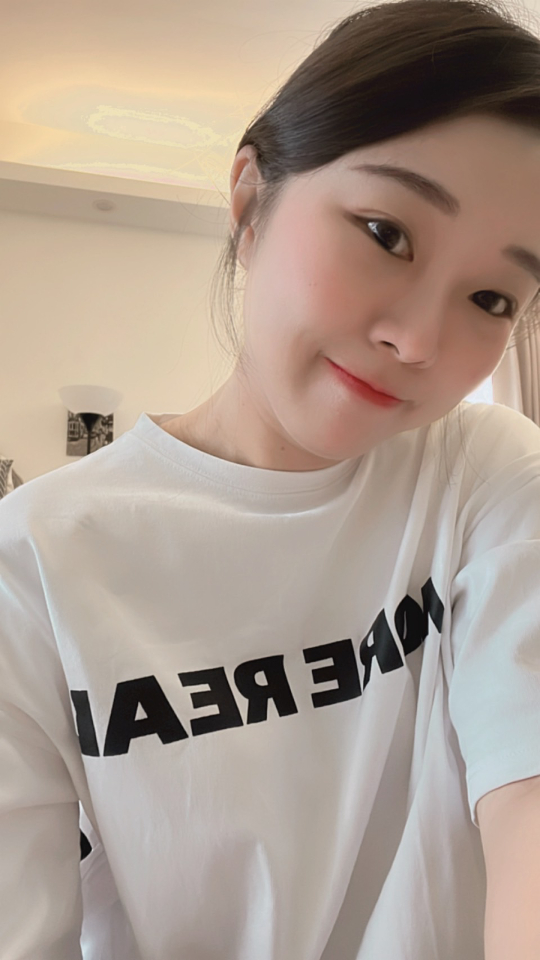 隱痕眼袋手術After,我現在每天都好喜歡照鏡子!還常常被同事稱讚氣色好很多